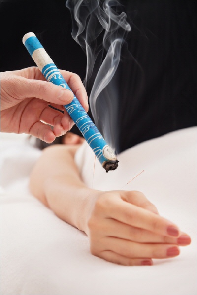 Moxibustion
