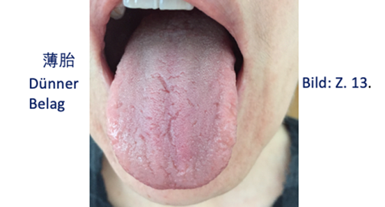 Zungendiagnostik