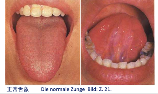 Zungendiagnostik