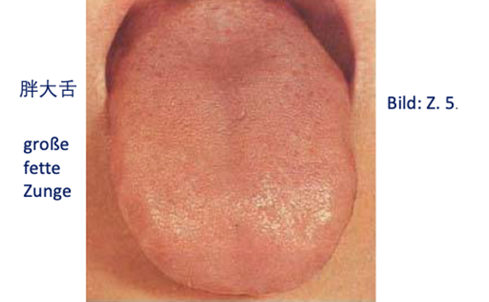 Zungendiagnostik